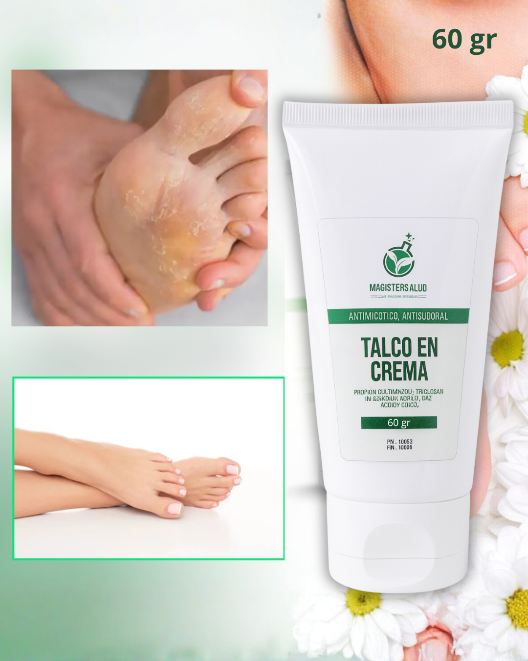 TALCO EN CREMA PARA HONGOS (TERBINAFINA)